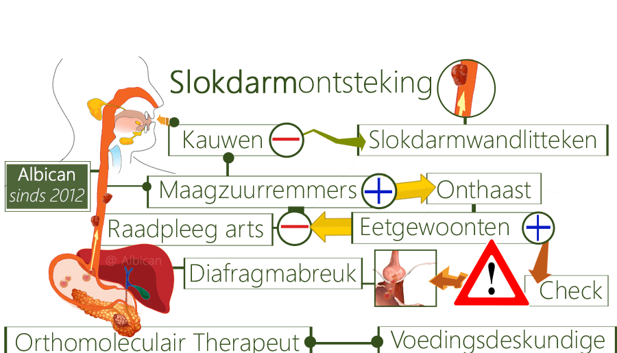 reflux, slokdarmontsteking wat slokdarmwandlittekenweefsel, maagzuurremmers, eetgewoonten, rust, verteringsproblemen, lokdarmvernauwing, slokdarmzweertjes, doorslikken, kauwen, slokdarmverzwering, gastro-oesofageale refluxziekte, slokdarmstent, buismaag, prestatiedruk, diafragmabreuk, ademhaling, Rennies, maagzuur, Malox, maagzuuroprisping, slokdarmklachten, MDL-arts, burn-out, melkproducten, gastroscopie, bloedarmoede, slokdarmtumor, tumorcontroles, slokdarmgezwel, slokdarmverzwering, bloedverlies, buismaagoperatie, buismaagherstel, buismaagingreep, thymuszwakte, tumoruitzaaiingen, bestraald, haaruitval, bijnieruitval, malabsorptiesyndroom, artrose, heiligbeenpijn, CT-scan, lichaamskrimp, polsbreuk werkdruk, cortisolstijging, DHEA-daling, osteoporose