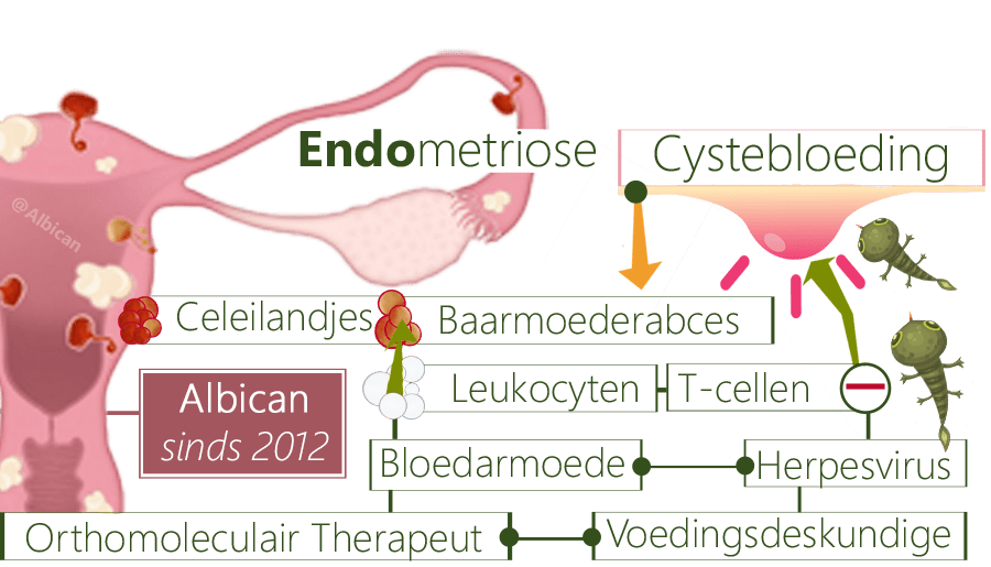 Endometriose, HPV, EPV, herpesvirus, vleesbomen, bloedarmoede, cel-eilandjes, oestrogeenschommelingen, cystevormingen, bloedinkjes, ontstekingsvocht, thymushormonen, T-cellen, lymfocyten, T-lymfocyten, obstipatie, schimmels, colitis ulcerosa, eileiderverkleving, eileiderontsteking, chlamydiabesmetting, chlamydiaklachten, PCOS, geslachtsgemeenschapspijn, galgangversperring, oxytocine, oxytocineblootstelling, postnatale depressie, oestradioldaling, menopauze, FSH, LH, endometriosebloedingen, endometriosesymptomen, gewichtstoename, dikke onderbuik, vaginisme, fyto-oestrogenen, buikklachten, humaan papillomavirus, Papillomavirus, Ovariumverlittekening, Baarmoederhalskanker