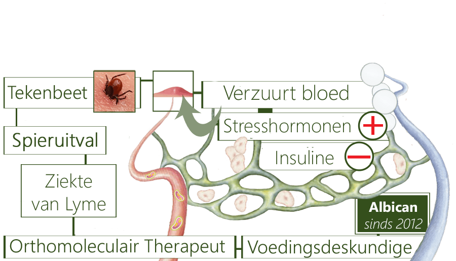 Ziekte van Lyme, bloedverzuring, antigenenmeting, Lymepatiënten, antibioticarecept, neuroborreliose, tekenbeetbacterie, bacterieopruimers, benenpijn, spierverlammingsverschijnselen, gezicht scheef, bewegingsstoornissen, spierdisfunctie, antibiotica, Lymeziekte, Lymestudiegroep, teek, tekentang, tekenwondje, borrelia-bacterie, teekverwijdering